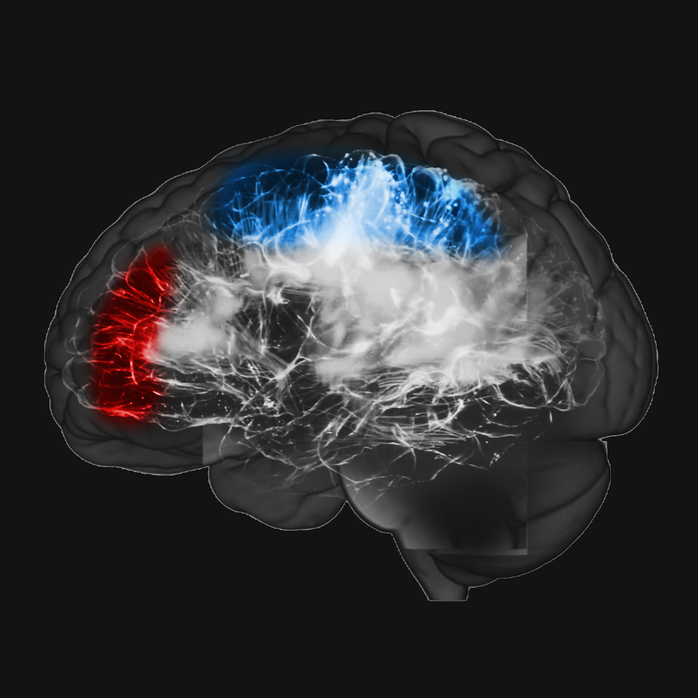 brain sq